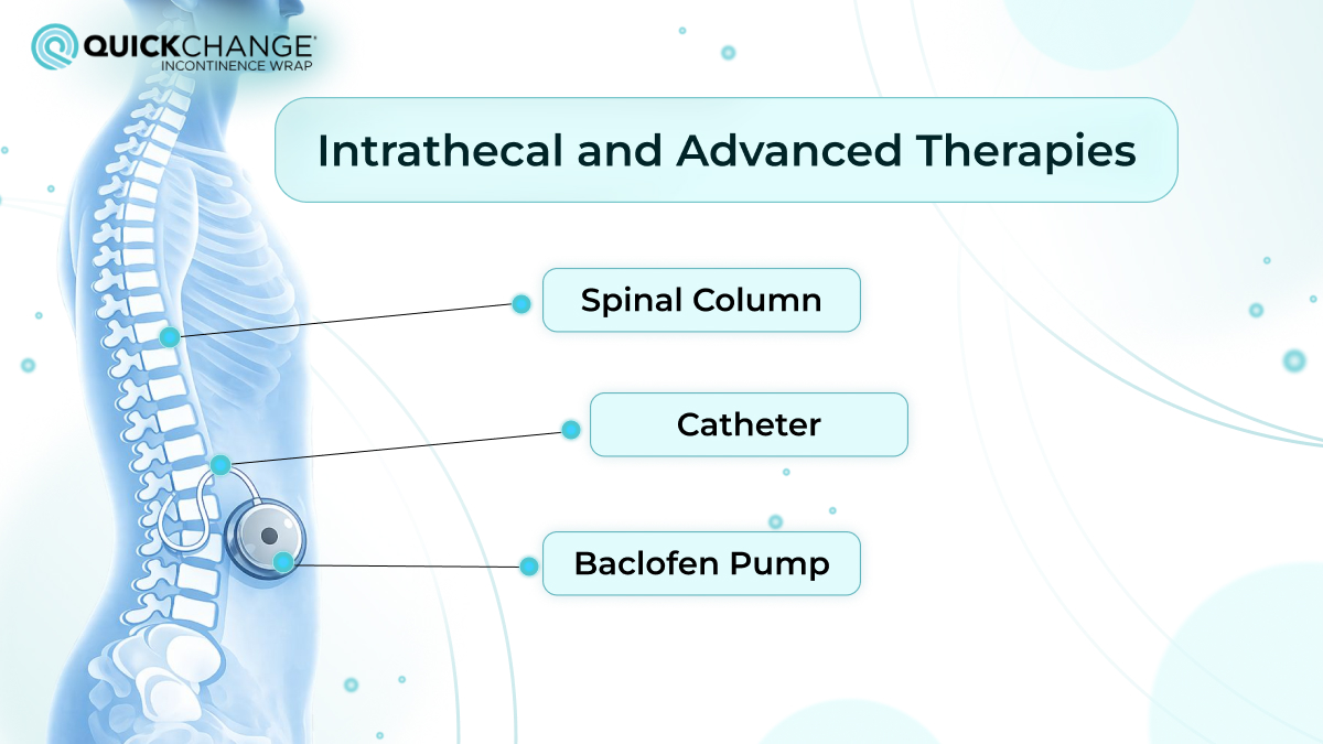 intrathecal baclofen pump therapy for spinal spasticity showing catheter and spinal column placement