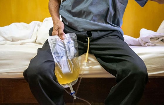 patient with a catheter