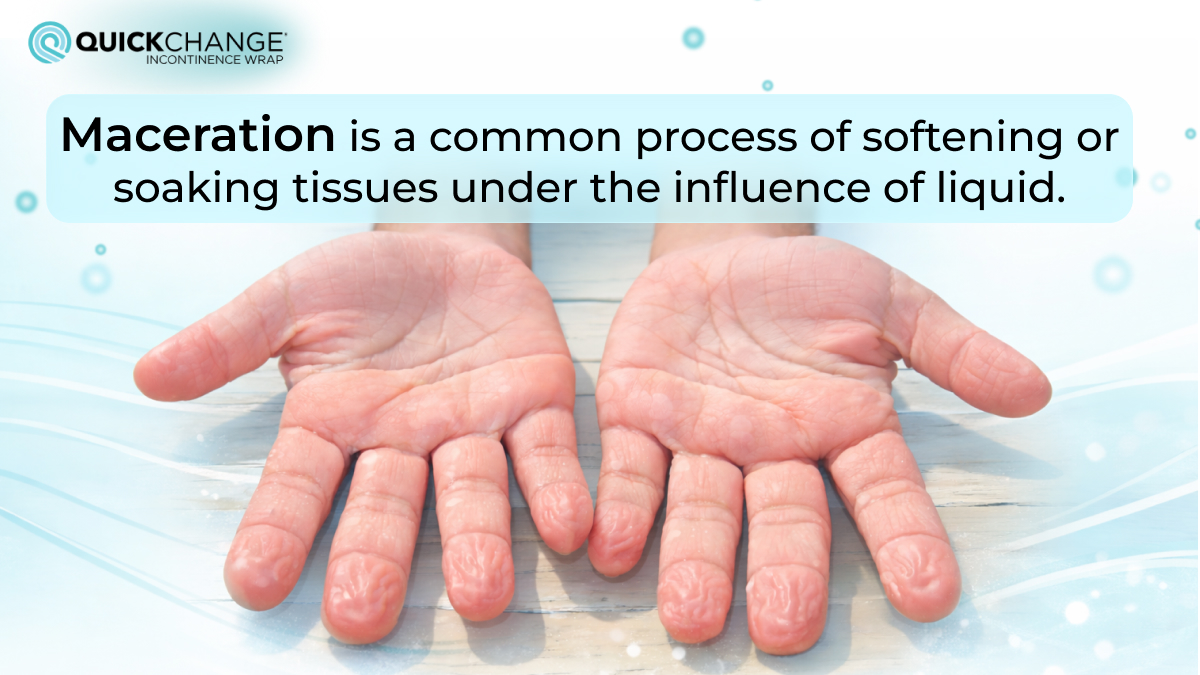 Hands with wrinkled skin illustrating maceration