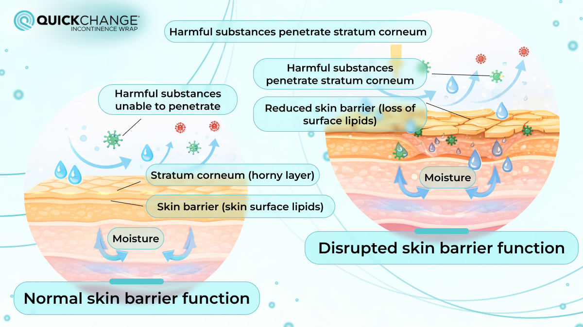 Image showing normal skin barrier function compared to disrupted skin barrier with moisture penetration and increased risk of irritation